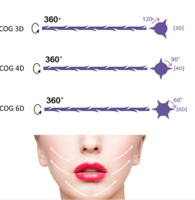 Medical PDO Pcl Nose Thread Lift Skin Care Tightening Threads Skin Treatment