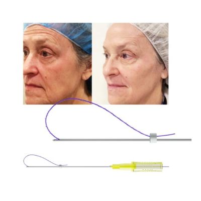3D 4D 6D PDO Thread Lift Nose Thread Injection Facelift Mono Tornado Screw