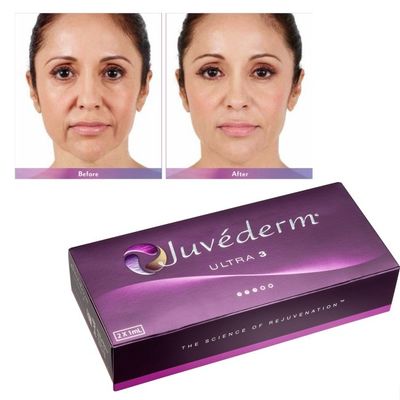 Hyaluronic Acid Juvederm Facial Filler Gel Smooth And Flawless Skin