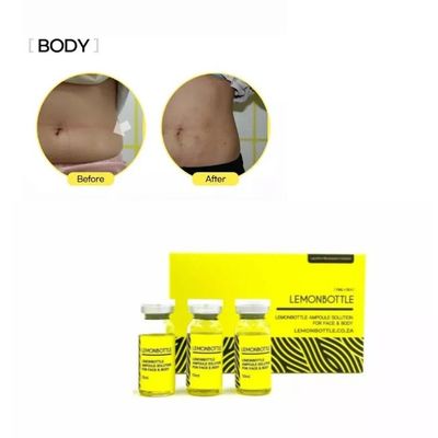 Sale Lemon Bottle Fat Dissolver 5X10ml Box Weight Loss Solution Online