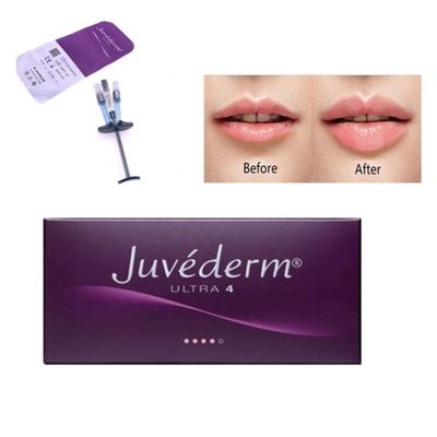 Allergan Juvederm Dermal Filler Injection Ultra4 With Lido