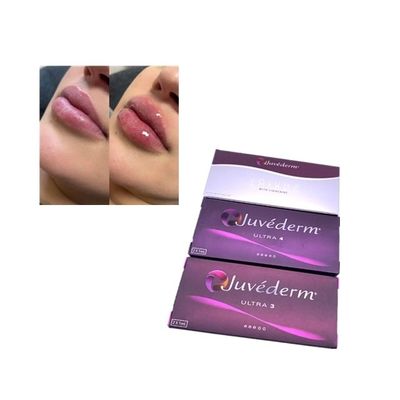 Injection Juvederm Voluma Cross Linked Dermal Filler