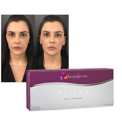 2ml Hyaluronic Acid Dermal Filler JUVEDERM Injectable Gel Wrinkle Filler