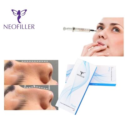 Neofiller Cross-linked Hyaluronic Acid Injection Gel with 24mg/ml Concentration and 9-12 Months Longevity for Hypodermic Injection
