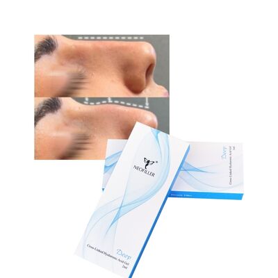 Cross linked Deep Line Filler 2ml Dermal filler for Nose Up
