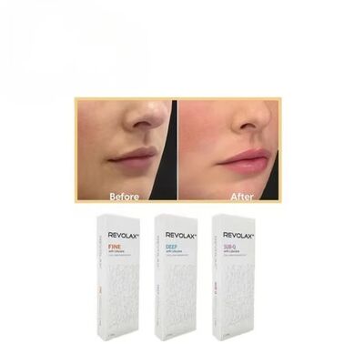 Korea Hyaluronic Acid Revolax Fine Deep Sub-Q Injectable Dermal Filler For Lip Volume
