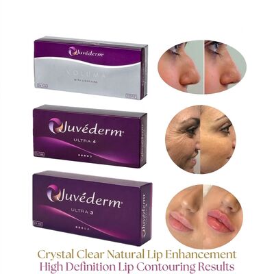 Volume Of Syringe 2 1ml Per Box Juvederm Voluma Filler Safety Facial Contouring Injectable Dermal Filler for Volume Enhancement