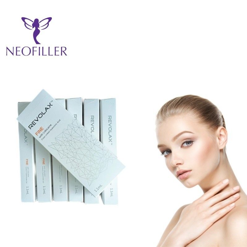 Chin Wrinkles Revolax Dermal Filler