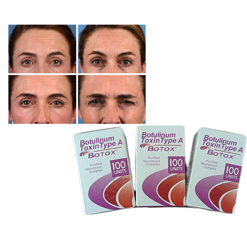 100U/vial Botulinum Toxin Type A Anti Wrinkle  Powder