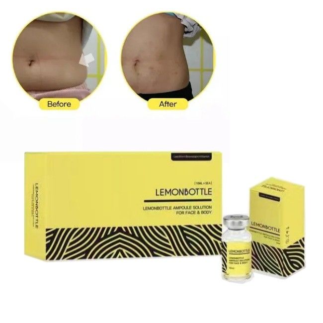 High Concentration Lemon Bottle Solution For Fat Dissolving Injections 5 Vials X 10ml Whole Body