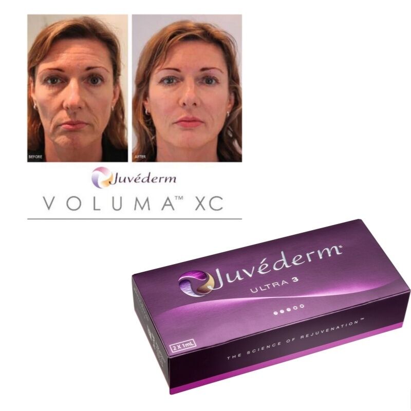 Juvederm Dermal Filler Injectable Gel with Hyaluronic Acid for 6-9 Months Duration and Room Temperature Storage