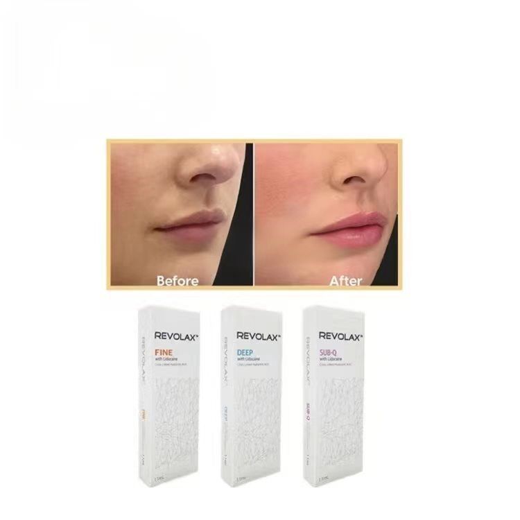 Fine Deep Sub-Q Revolax Dermal Filler Oem Yes Concentration Of Ha 24mg Injectable Gel For Facial Contouring And Volume