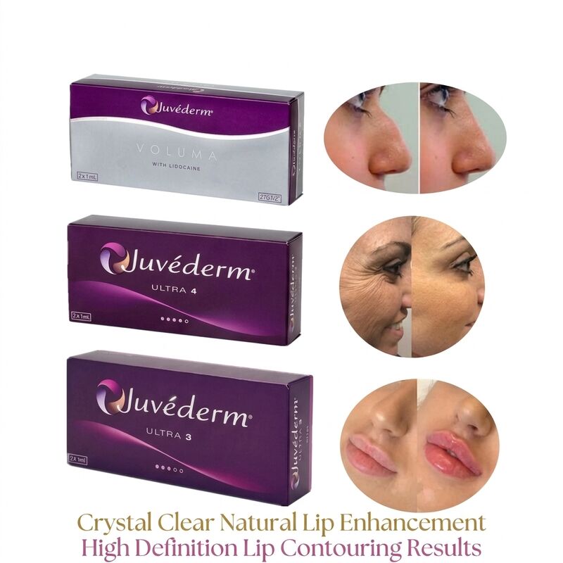 Volume Of Syringe 2 1ml Per Box Juvederm Voluma Filler Safety Facial Contouring Injectable Dermal Filler for Volume Enhancement